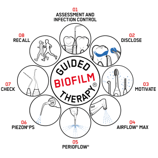 Guided biofilm therapy: un nuovo modo di concepire la seduta di igiene.